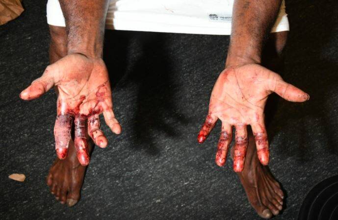 Blood on his hands: Photos of Petero Baleinapuka's hands were photographed after he was arrested. Picture: Supplied