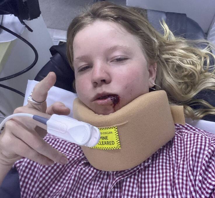 Olympic skateboarder Poppy Starr Olsen survives collision with truck
